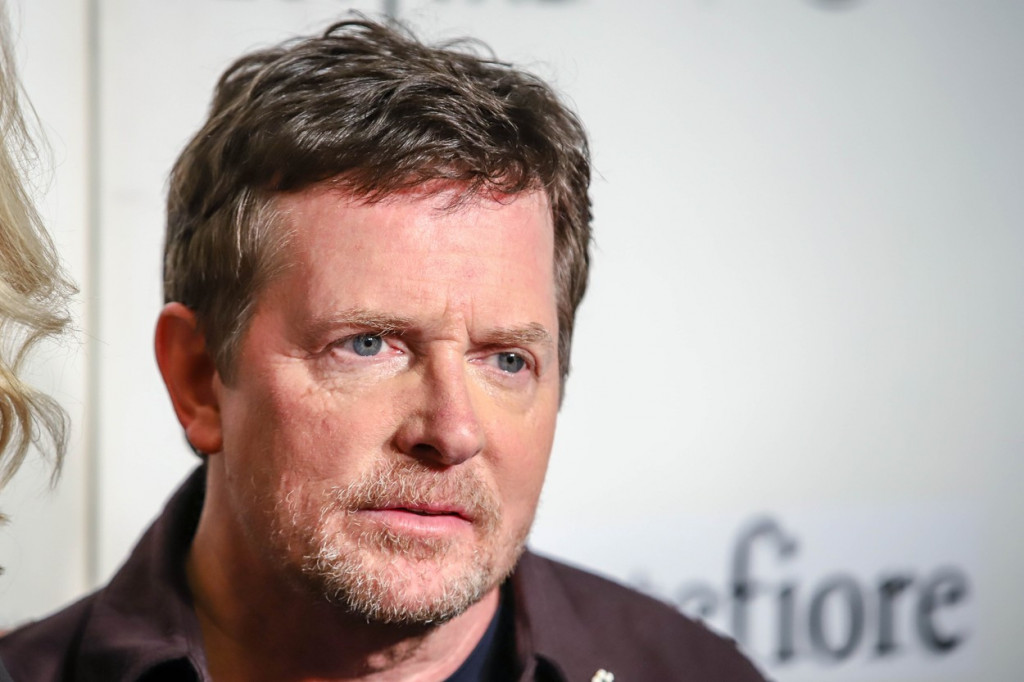 Majkl Džej Foks se uprkos teškoj bolesti vratio glumi