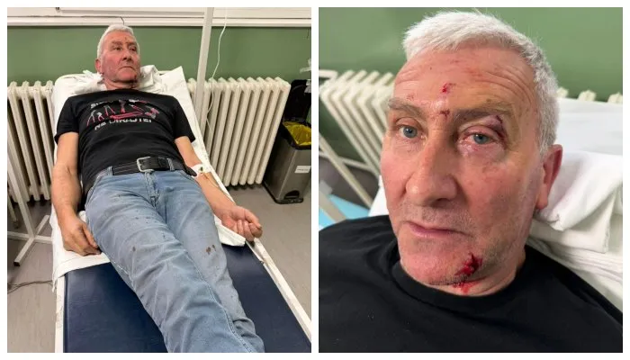 Predao se nasilnik iz Kosjerića koji je pretukao aktivistu u kabinetu predsednika opštine, određen mu prtivor